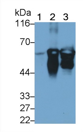 Polyclonal Antibody to Keratin 3 (KRT3)