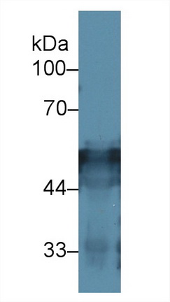 Polyclonal Antibody to Cytokeratin 16 (CK16)
