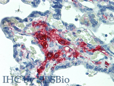 Polyclonal Antibody to Ferritin (FE)