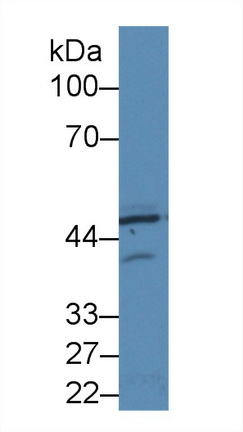 Polyclonal Antibody to Protein Kinase R (PKR)