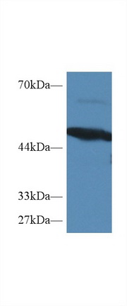 Polyclonal Antibody to Protein Kinase R (PKR)