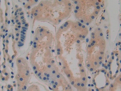 Polyclonal Antibody to Tissue Plasminogen Activator (tPA)