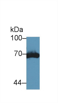 Polyclonal Antibody to Tissue Plasminogen Activator (tPA)