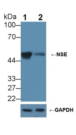 Polyclonal Antibody to Enolase, Neuron Specific (NSE)