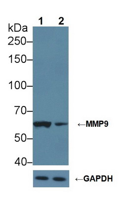 Polyclonal Antibody to Matrix Metalloproteinase 9 (MMP9)