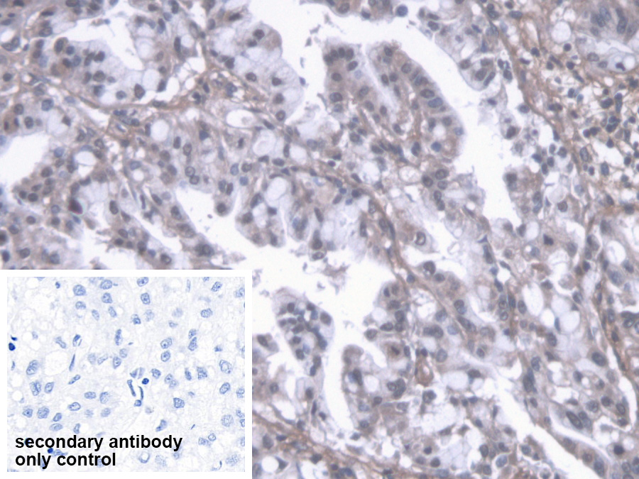 Polyclonal Antibody to Procollagen III N-Terminal Propeptide (PIIINP)