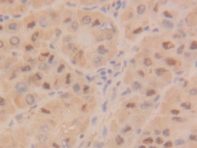 Polyclonal Antibody to Proliferating Cell Nuclear Antigen (PCNA)