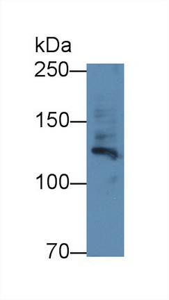 Polyclonal Antibody to Fibrillin 1 (FBN1)