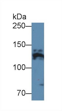Polyclonal Antibody to Fibrillin 1 (FBN1)