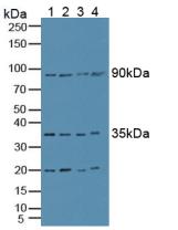 Polyclonal Antibody to Superoxide Dismutase Copper Chaperone