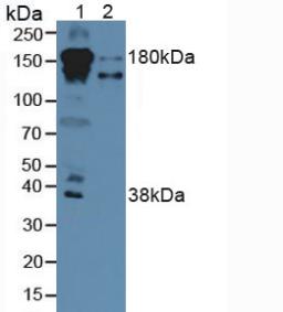 Polyclonal Antibody to Complement Factor H (CFH)