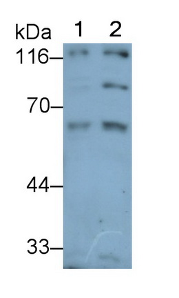 Polyclonal Antibody to Hexosaminidase B Beta (HEXb)