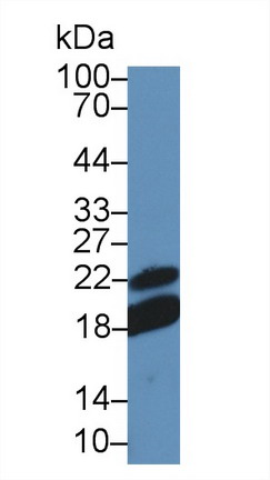 Polyclonal Antibody to Cluster Of Differentiation 28 (CD28)