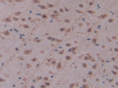 Polyclonal Antibody to Cluster Of Differentiation 28 (CD28)
