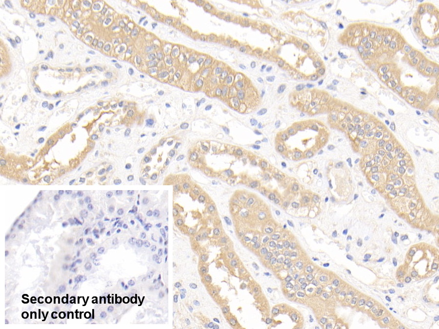 Polyclonal Antibody to Glutathione S Transferase Mu 1 (GSTM1)