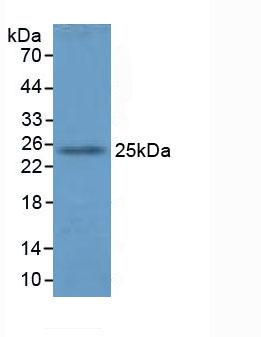 Polyclonal Antibody to Glutathione S Transferase A4 (GSTA4)