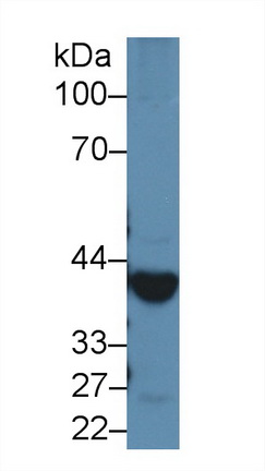 Polyclonal Antibody to Alcohol Dehydrogenase 1 (ADH1)