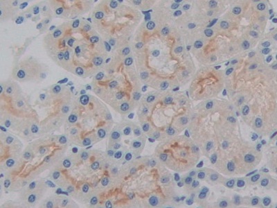 Polyclonal Antibody to Heparanase (HPSE)