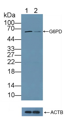 Polyclonal Antibody to Glucose-6-phosphate Dehydrogenase (G6PD)
