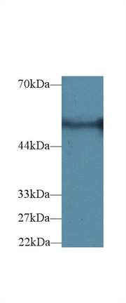 Polyclonal Antibody to Glucose-6-phosphate Dehydrogenase (G6PD)