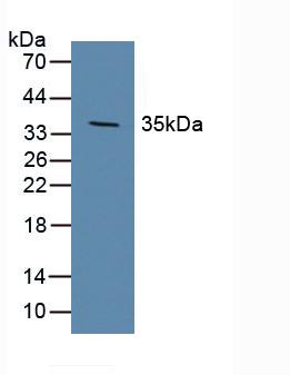 Polyclonal Antibody to Dickkopf Related Protein 1 (DKK1)