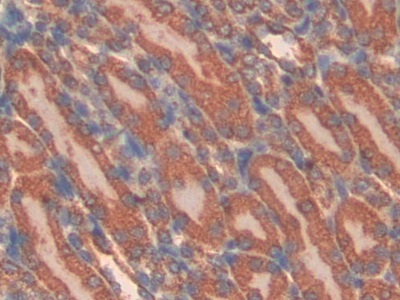 Polyclonal Antibody to Cluster Of Differentiation 38 (CD38)
