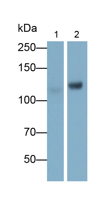 Polyclonal Antibody to Hexokinase 1 (HK1)