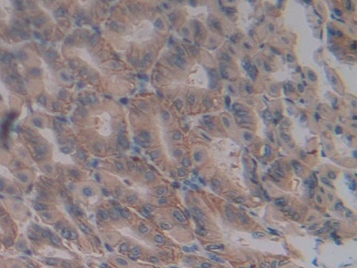 Polyclonal Antibody to Inducible T-Cell Co Stimulator Ligand (ICOSLG)