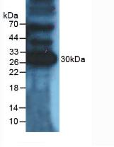 Polyclonal Antibody to Programmed Cell Death Protein 1 Ligand 1 (PDL1)