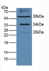 Polyclonal Antibody to Programmed Cell Death Protein 1 Ligand 1 (PDL1)