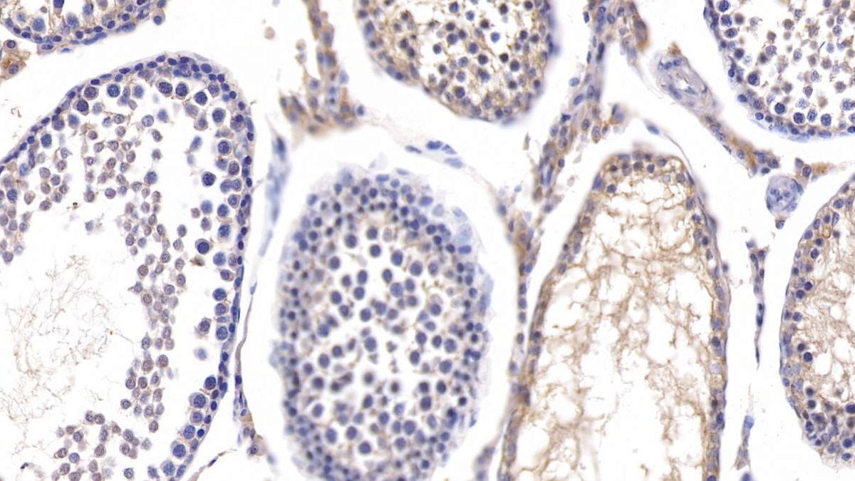 Polyclonal Antibody to Fucosidase Alpha L1, Tissue (FUCa1)