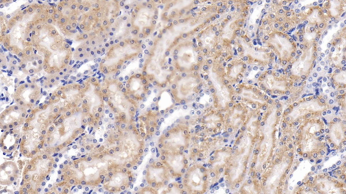 Polyclonal Antibody to Fucosidase Alpha L1, Tissue (FUCa1)