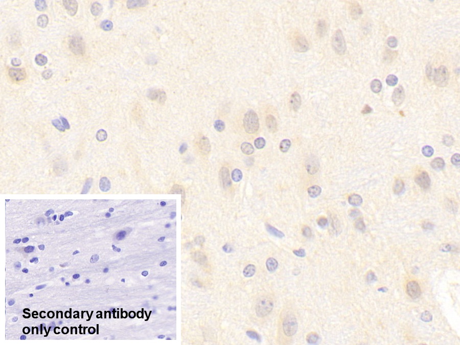 Polyclonal Antibody to Nitric Oxide Synthase 1, Neuronal (NOS1)