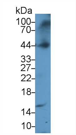 Polyclonal Antibody to Alpha-1-Acid Glycoprotein (a1AGP)