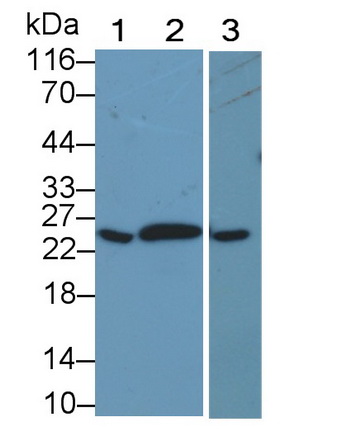 Polyclonal Antibody to C Reactive Protein (CRP)