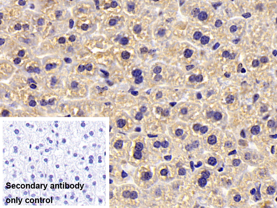 Polyclonal Antibody to Glycogen Phosphorylase, Muscle (PYGM)