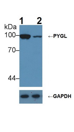 Polyclonal Antibody to Glycogen Phosphorylase, Liver (PYGL)