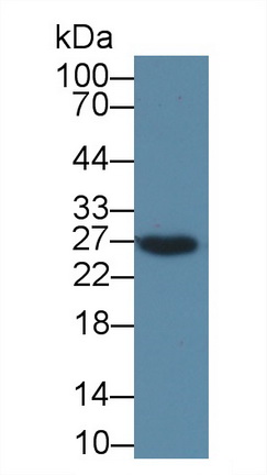 Polyclonal Antibody to Receptor Activator Of Nuclear Factor Kappa B Ligand (RANkL)