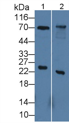 Polyclonal Antibody to Mannose Associated Serine Protease 2 (MASP2)