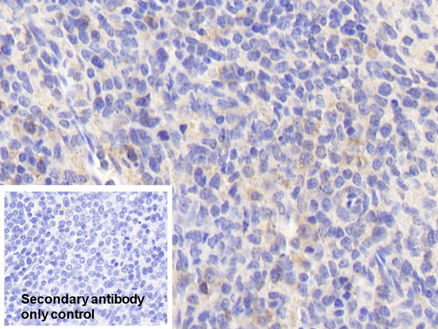 Polyclonal Antibody to Endothelial NOS (eNOS)