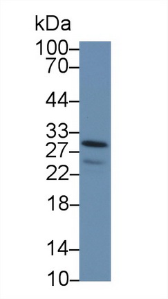 Polyclonal Antibody to Carbonic Anhydrase I (CA1)