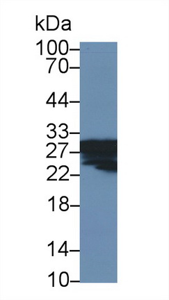 Polyclonal Antibody to Carbonic Anhydrase I (CA1)