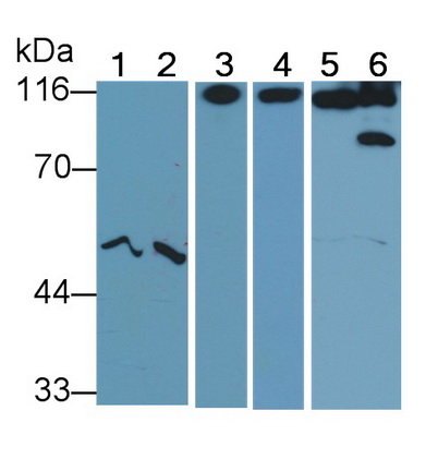 Polyclonal Antibody to Cluster Of Differentiation 26 (CD26)
