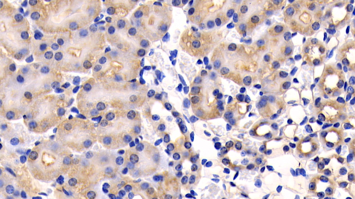 Polyclonal Antibody to Cluster Of Differentiation 26 (CD26)