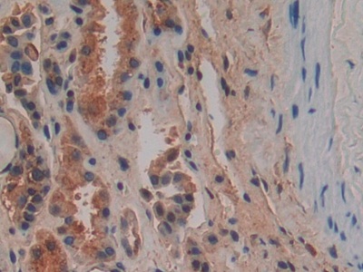 Polyclonal Antibody to Osteopontin (OPN)