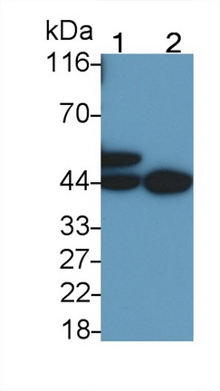 Polyclonal Antibody to Tumor Protein p53 (P53)