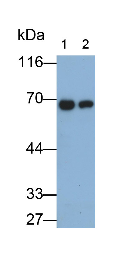 Polyclonal Antibody to Phosphoenolpyruvate Carboxykinase 1, Soluble (PCK1)