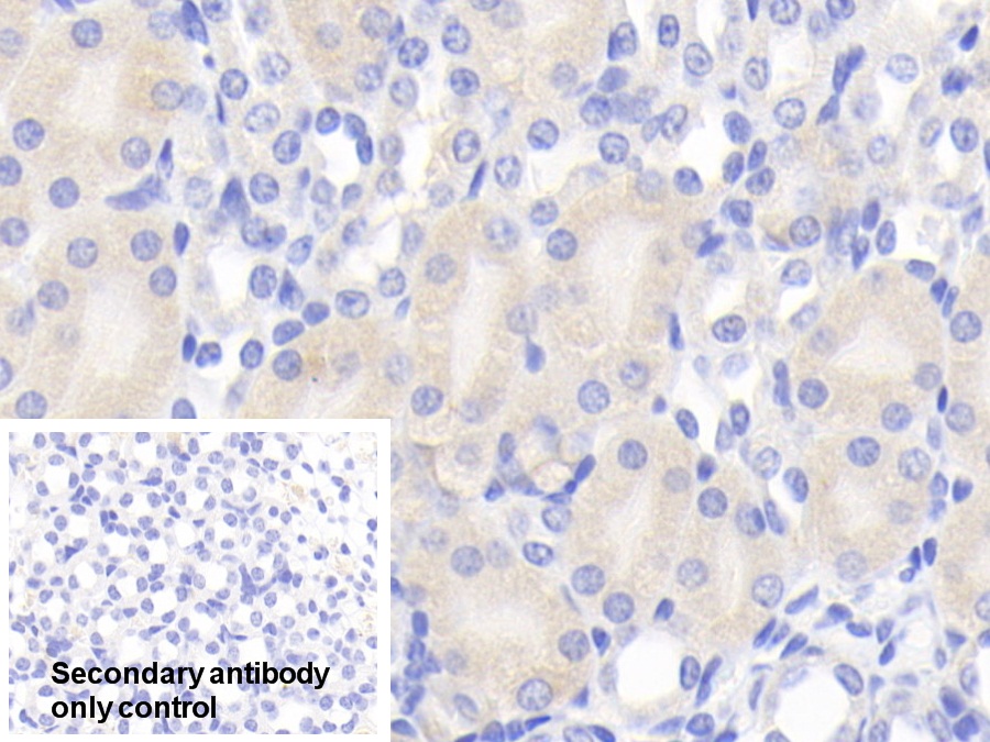 Polyclonal Antibody to Chemerin (CHEM)