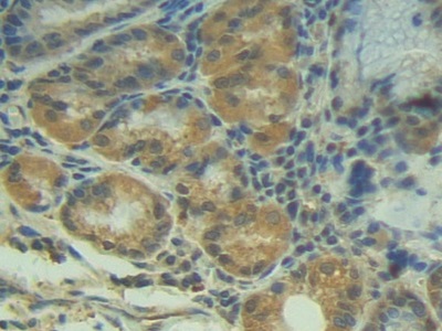 Polyclonal Antibody to Placental Cadherin (P-cadherin)