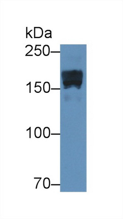Polyclonal Antibody to Alpha-2-Macroglobulin (a2M)
